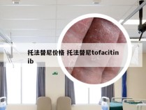 托法替尼价格 托法替尼tofacitinib