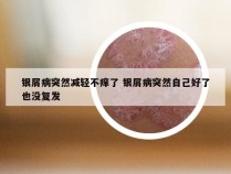 银屑病突然减轻不痒了 银屑病突然自己好了也没复发