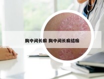 胸中间长癣 胸中间长癣结痂