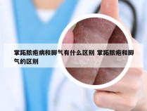 掌跖脓疱病和脚气有什么区别 掌跖脓疱和脚气的区别