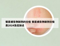 银屑病生物制剂的价格 银屑病生物制剂价格表2024及优缺点