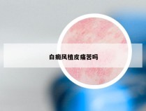 白癜风植皮痛苦吗