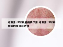维生素d3对银屑病的作用 维生素d3对银屑病的作用与功效