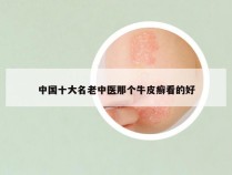 中国十大名老中医那个牛皮癣看的好