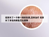 后背长了一个癣一样的东西,怎样治疗 后背长了多处的癣是怎么回事