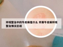 环境整治中的牛皮癣是什么 开展牛皮癣环境整治情况总结