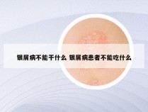 银屑病不能干什么 银屑病患者不能吃什么