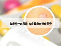 台癣用什么药治 治疗苔癣有哪些药膏