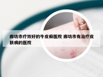 廊坊市疗效好的牛皮癣医院 廊坊市有治疗皮肤病的医院