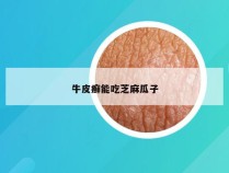 牛皮癣能吃芝麻瓜子
