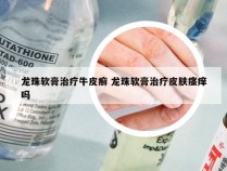 龙珠软膏治疗牛皮癣 龙珠软膏治疗皮肤瘙痒吗