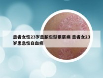患者女性23岁患脓包型银屑病 患者女23岁患急性白血病