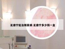 足康宁能治银屑病 足康宁多少钱一盒