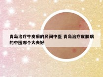 青岛治疗牛皮癣的民间中医 青岛治疗皮肤病的中医哪个大夫好