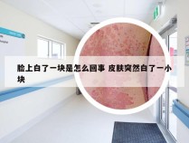 脸上白了一块是怎么回事 皮肤突然白了一小块