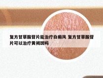 复方甘草酸苷片能治疗白癜风 复方甘草酸苷片可以治疗黄褐斑吗