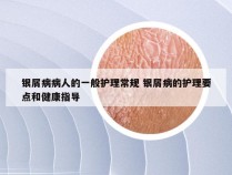 银屑病病人的一般护理常规 银屑病的护理要点和健康指导