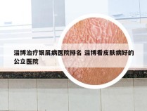 淄博治疗银屑病医院排名 淄博看皮肤病好的公立医院