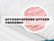 治疗牛皮皮癣中成药膏有哪些 治疗牛皮皮癣中成药膏有哪些药