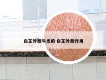 白芷外敷牛皮癣 白芷外敷作用