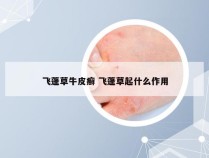 飞蓬草牛皮癣 飞蓬草起什么作用
