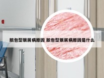 脓包型银屑病原因 脓包型银屑病原因是什么