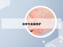 秋季牛皮癣养护