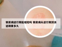 银屑病进行期能缩短吗 银屑病从进行期到消退期要多久