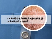 sapho综合征和银屑病关节炎的区别 sapho综合征能治愈吗