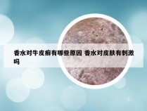 香水对牛皮癣有哪些原因 香水对皮肤有刺激吗