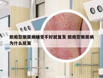 脓疱型银屑病睡觉不好就复发 脓疱型银屑病为什么反复