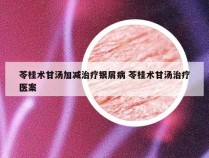 苓桂术甘汤加减治疗银屑病 苓桂术甘汤治疗医案