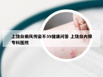 上饶白癜风传染不39健康问答 上饶白内障专科医院