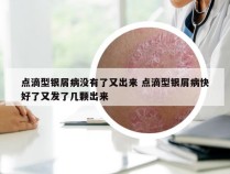 点滴型银屑病没有了又出来 点滴型银屑病快好了又发了几颗出来
