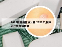 2025银屑病重点公益 2022年,国家治疗银屑病成果