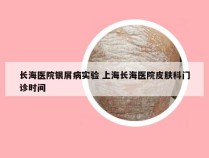 长海医院银屑病实验 上海长海医院皮肤科门诊时间