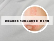 白癜风做手术 白点癫风治疗费用一般多少钱