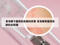 青岛哪个医院的皮肤科厉害 青岛哪家医院皮肤科比较强