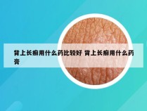 背上长癣用什么药比较好 背上长癣用什么药膏