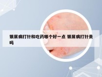 银屑病打针和吃药哪个好一点 银屑病打针贵吗