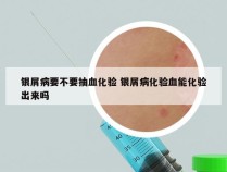 银屑病要不要抽血化验 银屑病化验血能化验出来吗
