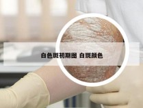白色斑初期图 白斑颜色