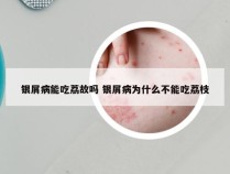 银屑病能吃荔故吗 银屑病为什么不能吃荔枝