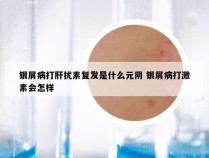 银屑病打肝扰素复发是什么元阴 银屑病打激素会怎样