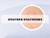 宝鸡治疗银屑病 宝鸡治疗银屑病医生