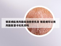 银屑病能用丙酸氯倍他索乳膏 银屑病可以用丙酸氟替卡松乳膏吗