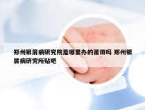 郑州银屑病研究院是哪里办的莆田吗 郑州银屑病研究所贴吧