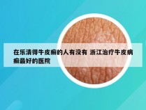 在乐清得牛皮癣的人有没有 浙江治疗牛皮病癣最好的医院