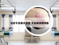 社区牛皮癣大清理 牛皮癣清理神器