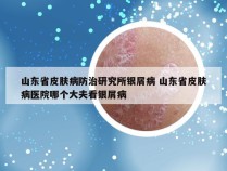 山东省皮肤病防治研究所银屑病 山东省皮肤病医院哪个大夫看银屑病